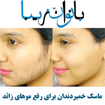 فیلم از بین بردن و رفع موهای زائد دوبله فارسی