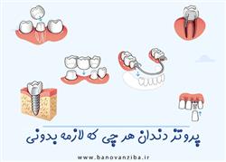 پروتز دندان چیست